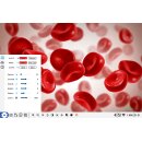 Tablet-Mikroskopkamera ODC 251 HD-Tablet mit integrierter 4K-Kamera